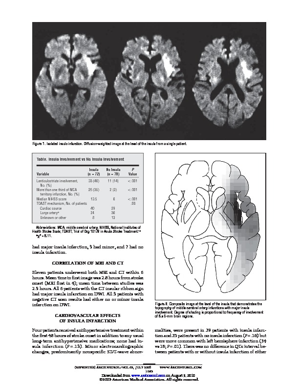 Download Insular cortex infarction in acute middle cerebral artery territory stroke: predictor of stroke severity and vascular lesion.
